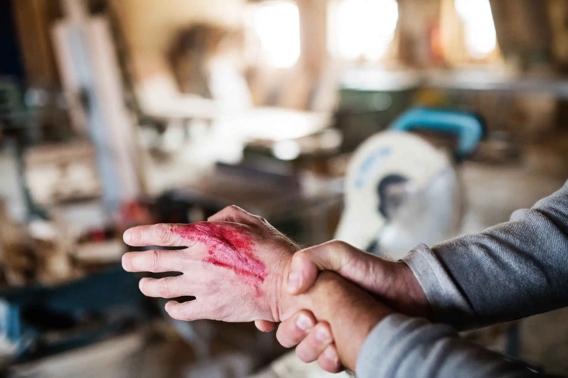Yamin Law Group burn injury lawyers helping victims injured by fire or chemicals